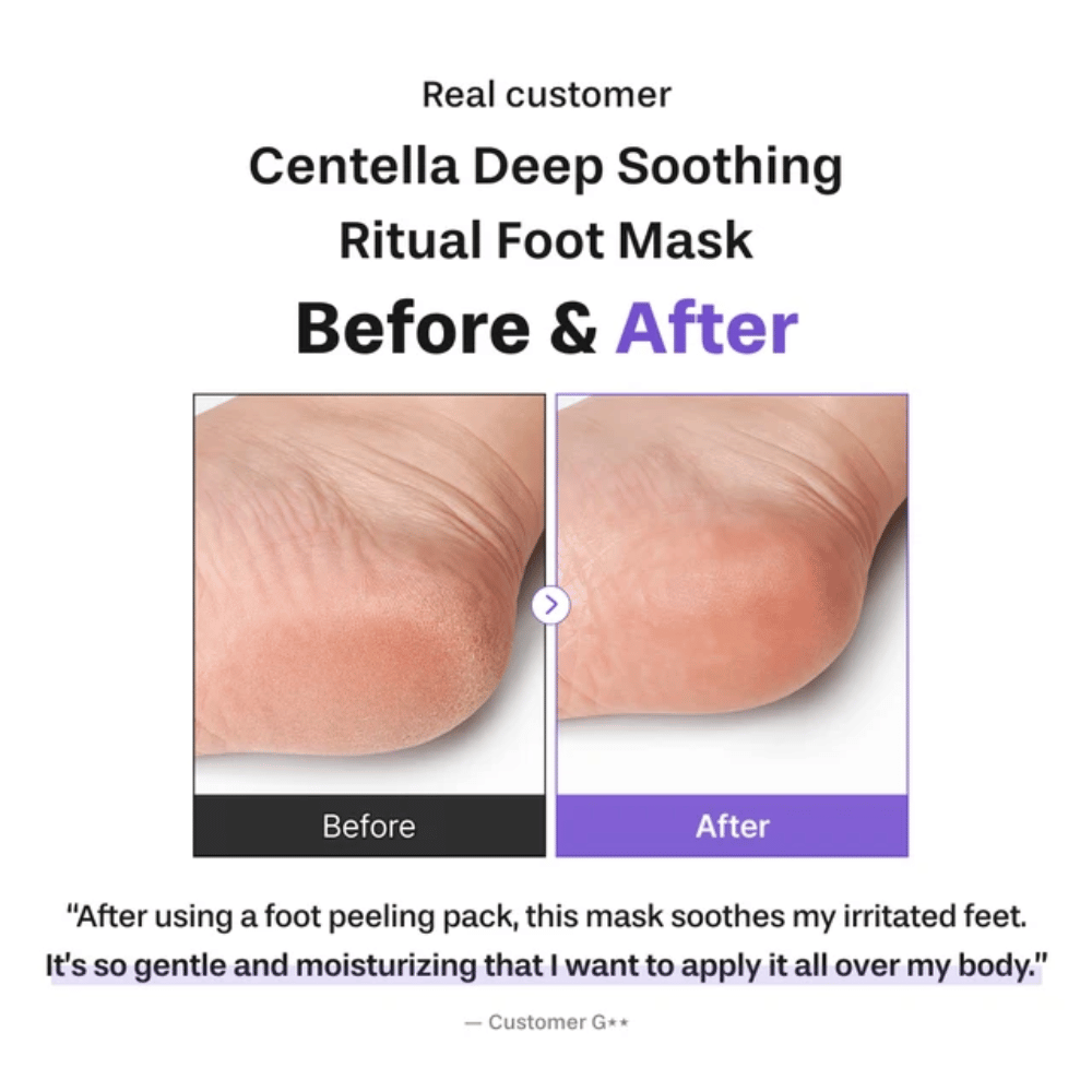 6. Baren Centella Deep Soothing Ritual Foot Mask – εικόνα πριν και μετά που δείχνει μια πιο απαλή και πιο ενυδατωμένη φτέρνα μετά τη χρήση