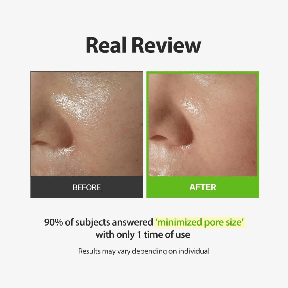 SUNGBOON EDITOR Green Tomato Pore Peeling Jumbo Pad – εικόνα πριν και μετά με έμφαση στους ορατούς πόρους