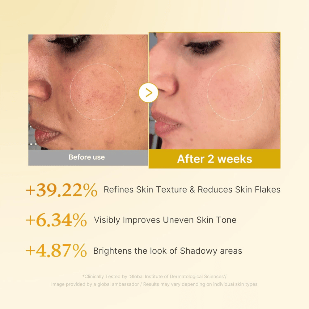 Εικόνα πριν και μετά για το Medicube Kojic Acid Turmeric Resurfacing Toner που δείχνει βελτιωμένη υφή δέρματος, πιο ομοιόμορφο τόνο και μειωμένα ξηρά λέπια μετά από δύο εβδομάδες χρήσης.