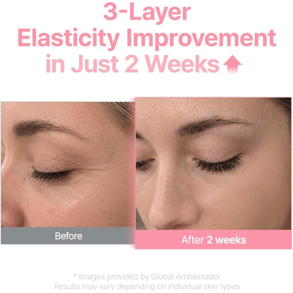 Εικόνα πριν και μετά για το Purito Multi PDRN Collagen EGF Serum που δείχνει βελτιωμένη ελαστικότητα της επιδερμίδας μετά από δύο εβδομάδες.