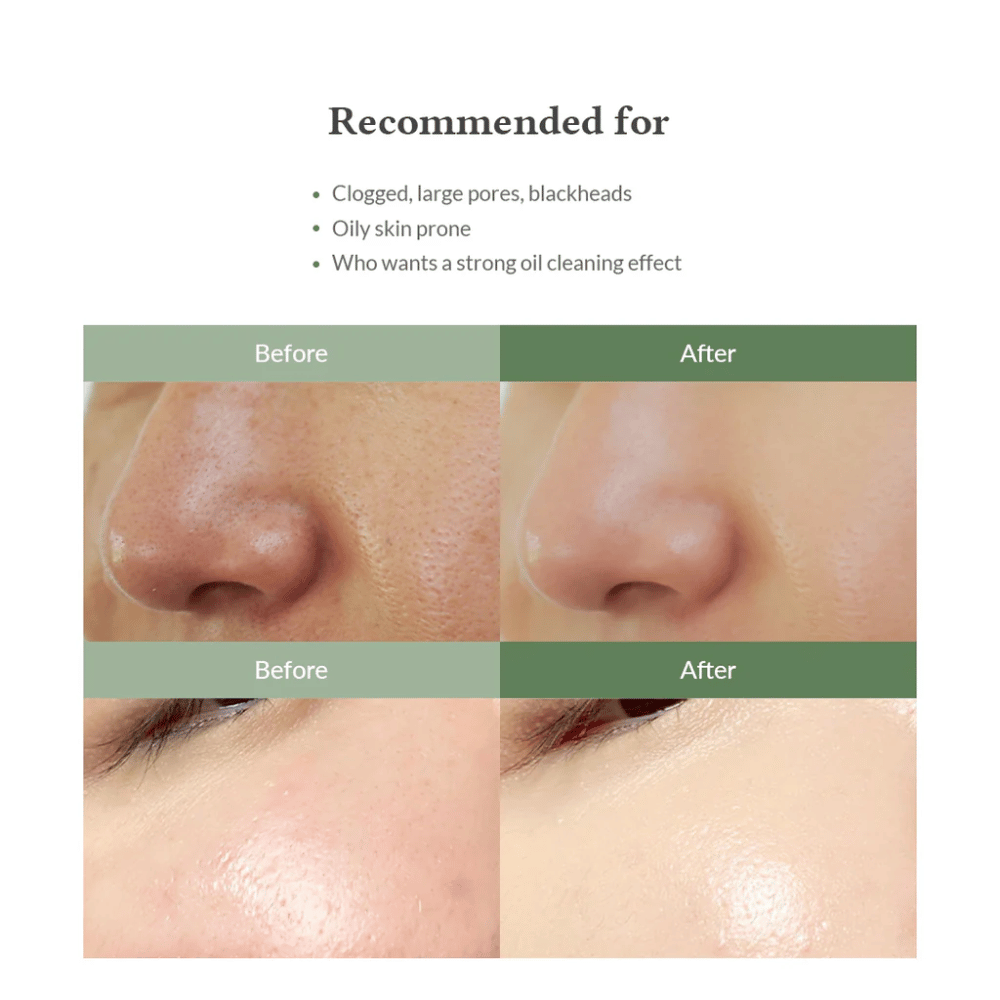 Dr. Althea Premium Quick Step Sebum Cleanser – καθαριστικό προσώπου που βοηθά στη μείωση των μαύρων στιγμάτων, στον βαθύ καθαρισμό των πόρων και στην επίτευξη μιας πιο ομοιόμορφης υφής δέρματος.