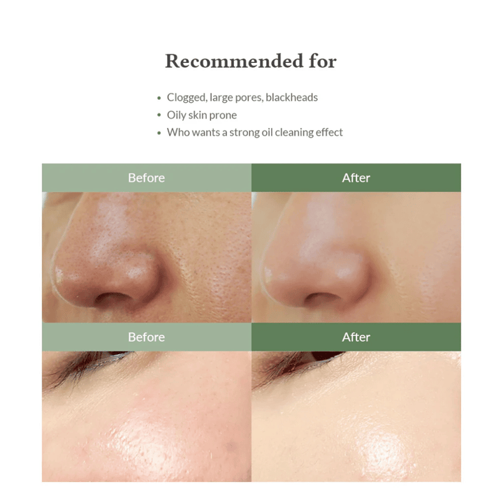 Dr. Althea Premium Quick Step Sebum Cleanser – καθαριστικό προσώπου που βοηθά στη μείωση των μαύρων στιγμάτων, στον βαθύ καθαρισμό των πόρων και στην επίτευξη μιας πιο ομοιόμορφης υφής δέρματος.