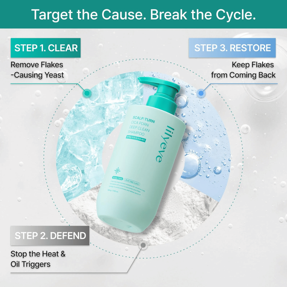 LILYEVE Scalp:Turn Cica PDRN Deep Clean Shampoo καθαρίζει το τριχωτό της κεφαλής, καταπολεμά την πιτυρίδα και την περίσσεια σμήγματος και βοηθά στην πρόληψη επαναλαμβανόμενων προβλημάτων.